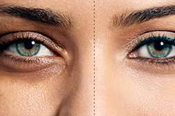ΠΠ°ΡΡΠΈ ΠΠ»ΡΠΊ ΠΈΠ½ΠΊ ΡΠ±ΠΈΡΠ°ΡΡ ΠΌΠΎΡΡΠΈΠ½Ρ