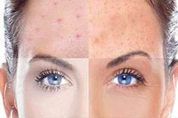 Крем Meduskin подходит для любого типа кожи.