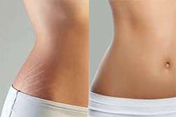Мазь Elaskin имеет омолаживающий эффект.