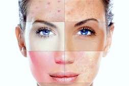 Маска Platinum Mask актуальна для омолаживающих процедур при любом типе кожи.