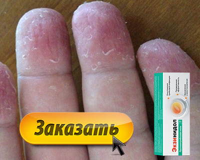 Мазь Экзинидол купить по доступной цене.
